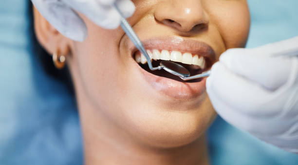 Best Pediatric Emergency Dentist in Fort Polk North, LA
