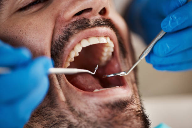 Best Same-Day Emergency Dentist in Fort Polk North, LA