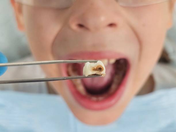 Best Emergency Orthodontic Repairs in Fort Polk North, LA