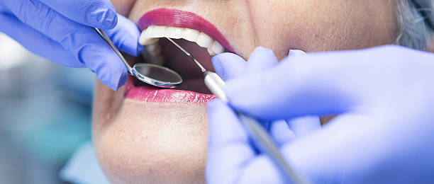 Best Same-Day Emergency Dentist in Fort Polk North, LA